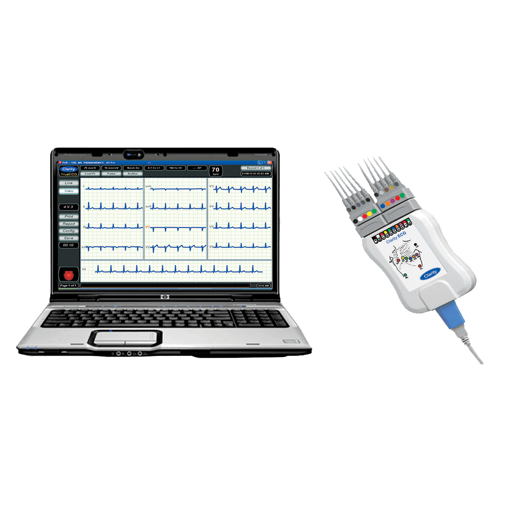 Clarity ECG